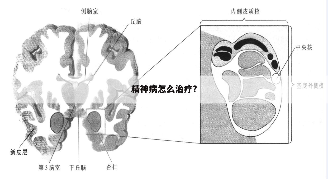 精神病怎么治疗？