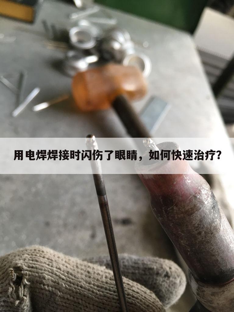 用电焊焊接时闪伤了眼睛，如何快速治疗？