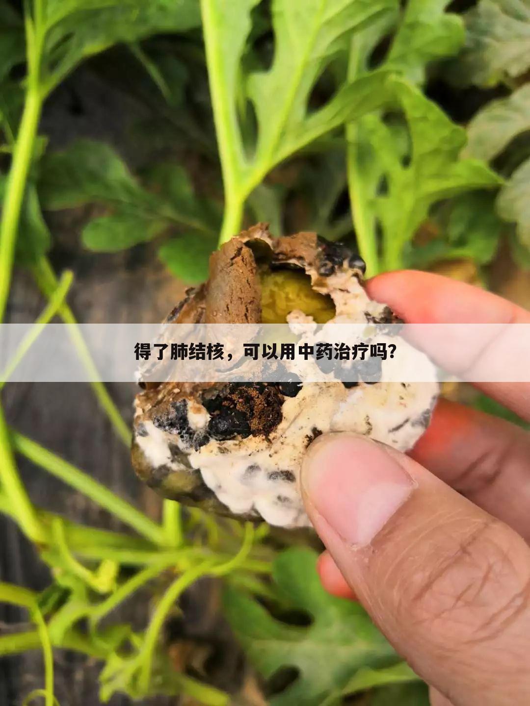 得了肺结核，可以用中药治疗吗？