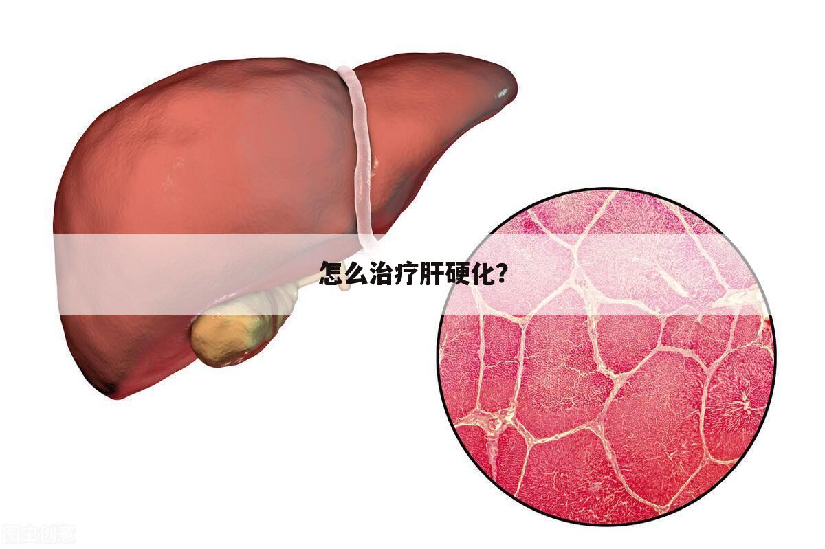 怎么治疗肝硬化？